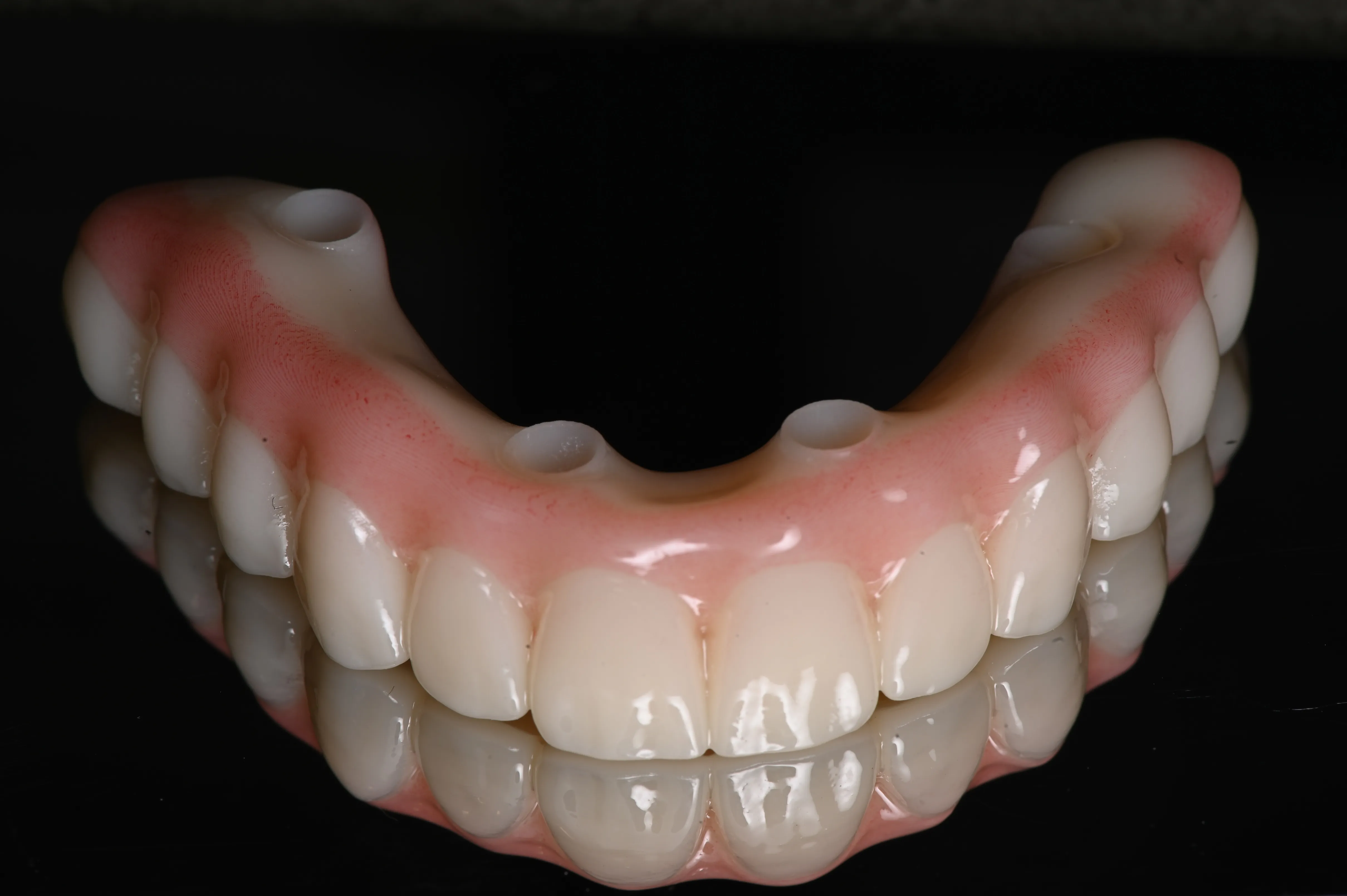Zirconia crown and bridge